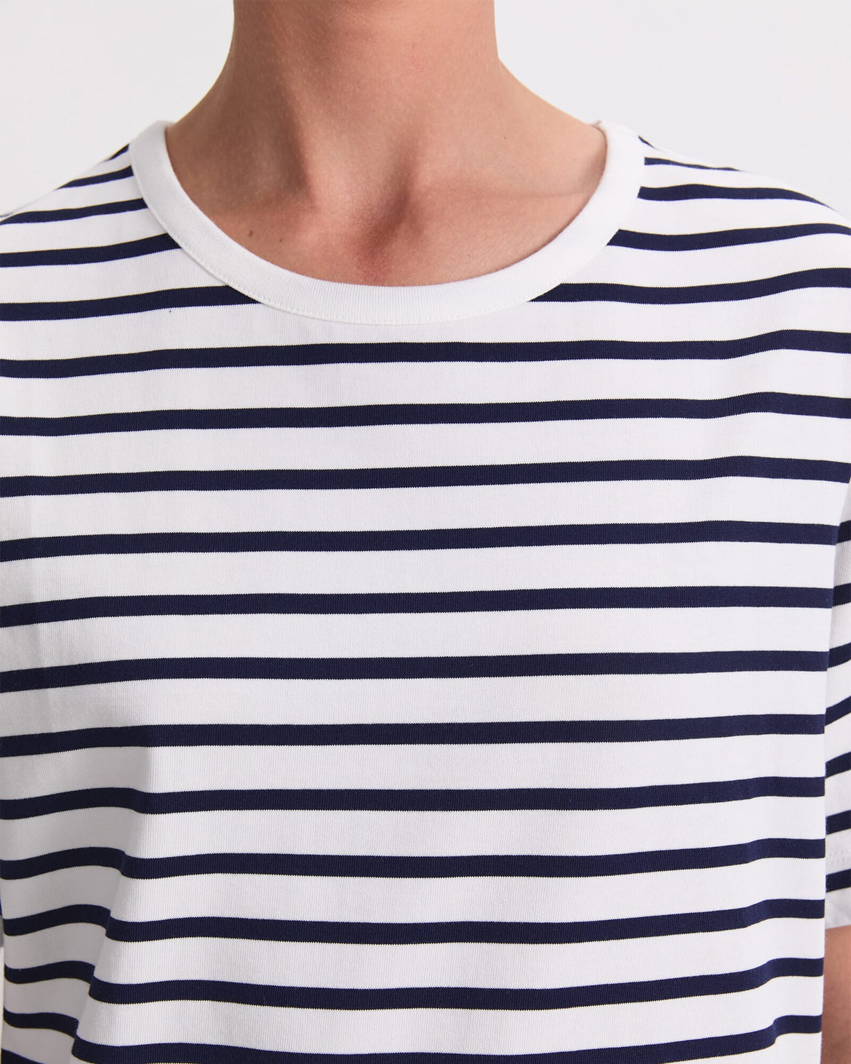Stripe Shopper Mini Dress